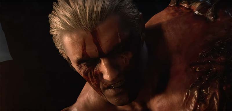 Krauser