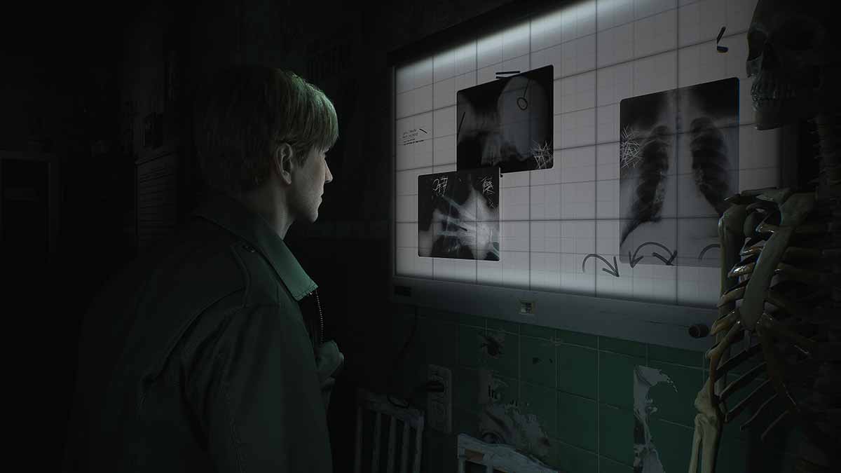 Bloober Team Says Silent Hill 2 PS5 Is Progressing Smoothly, Working to  Attain the Highest Quality